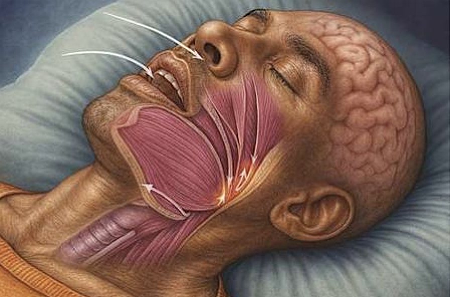 Ilustración anatómica de una persona dormida y el paso del aire por nariz y garganta